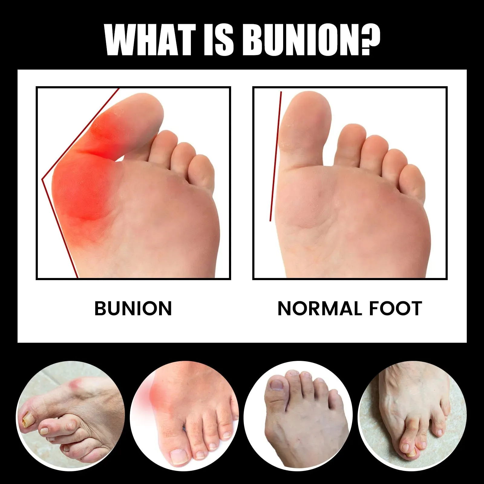 Orthofeet Bunion Relief Socks